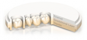 Zirconia